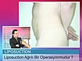 Liposuction Ameliyat A r l Bir Operasyonmudur  | BahVideo.com