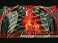 Fibrillation auriculaire une anomalie cardiaque | BahVideo.com