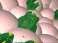 Peptic Ulcer 3D | BahVideo.com