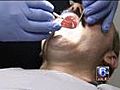 Healthcheck: Free dental care for uninsured | BahVideo.com
