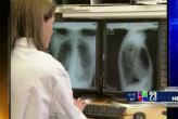  Qu es la fibrosis pulmonar  | BahVideo.com