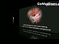 Mesterolone Proviron advantage and negative  | BahVideo.com