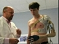 Man who cut off own arm gets bionic limb | BahVideo.com