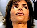 Lisa Rinna s Lips Aren amp 039 t Healing | BahVideo.com