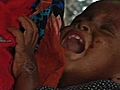 Somalia Hungersnot vor Augen | BahVideo.com