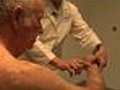 Laser Tool Helps Doctors Detect Melanoma | BahVideo.com