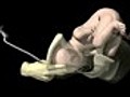 Forceps in Child Birth | BahVideo.com