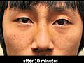 Asian Nose Enhancement in 10 minutes | BahVideo.com