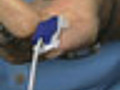 VENDYS Fingertip Blood Pressure Test | BahVideo.com