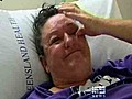 Cairns woman attacked by friend s pitbulls | BahVideo.com