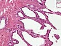 Histology of Seminal Vescicles | BahVideo.com
