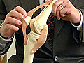 Quadriceps-Sparing Knee Replacement | BahVideo.com