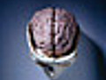 Brain Injury | BahVideo.com