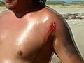 En direct il se fait mordre par un requin  | BahVideo.com