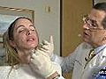 Facial fillers becoming more popular | BahVideo.com