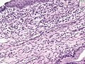 Histology of Cervix | BahVideo.com