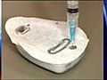 New type of insulin pump - omnipod | BahVideo.com