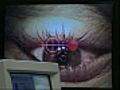 Artificial cornea shows promise in restoring vision | BahVideo.com