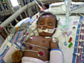 Baby Tiana Fights for Her Life | BahVideo.com
