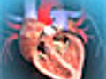 Aortic Valve Replacement Animation | BahVideo.com