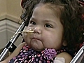 Baby Undergoes Risky 7-Organ Transplant | BahVideo.com
