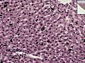 Histology of Liver Kupffer Cells | BahVideo.com