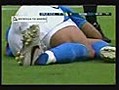 La peor lesion del futbo  | BahVideo.com
