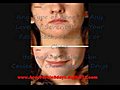 Acne Free In 3days ebook pdf - Ways To  | BahVideo.com