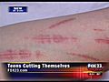 Teens Cutting Themselves | BahVideo.com