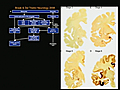 Imaging Network Connectivity Disruptions in Neurodegenerative Disease | BahVideo.com