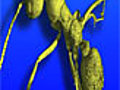 News X-Ray Vision Shows Dino-Era Bugs | BahVideo.com