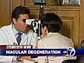 Treating macular degeneration | BahVideo.com