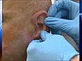 Soldier receives prosthetic ear | BahVideo.com
