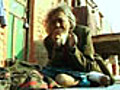 India s leprosy problem political social and legal | BahVideo.com