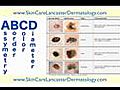 Dermatologists in Lancaster PA - Dermatologists Lancaster PA | BahVideo.com