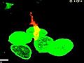 Cure clues from cancer cell close-up | BahVideo.com