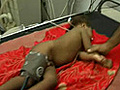 Encephalitis leaves 200 dead in Gorakhpur | BahVideo.com