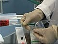 Arterial Blood Gas Sampling Technique Video | BahVideo.com