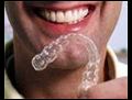 Ortodonti hangi yaslarda uygulanabilir  | BahVideo.com