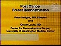 Post Cancer Breast Reconstruction | BahVideo.com
