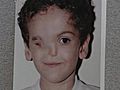 NY Doctors Help Boy Born With Half A Face | BahVideo.com