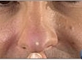 Men s Skin Care - Treating Acne | BahVideo.com