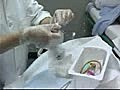 Female Foley Catheterization Technique | BahVideo.com