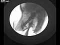 Xray Of Dog Drinking Water | BahVideo.com
