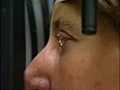 Augenlaseroperation | BahVideo.com