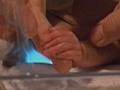 ECU Preemie baby hand | BahVideo.com
