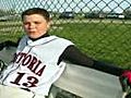 Rare surgery turns Ohio teen s leg backwards | BahVideo.com