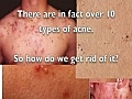 How To Get Rid Of Acne On Back | BahVideo.com