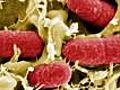  C mo se contagia la bacteria E coli  | BahVideo.com