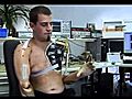 Europe s First Bionic Man Dies in Car Crash | BahVideo.com